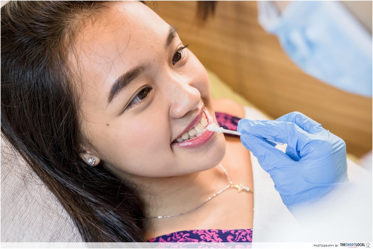 Mirage Aesthetic Teeth Whitening Applying Protective Gels