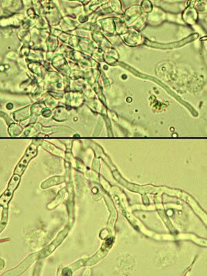 bacteria in pee