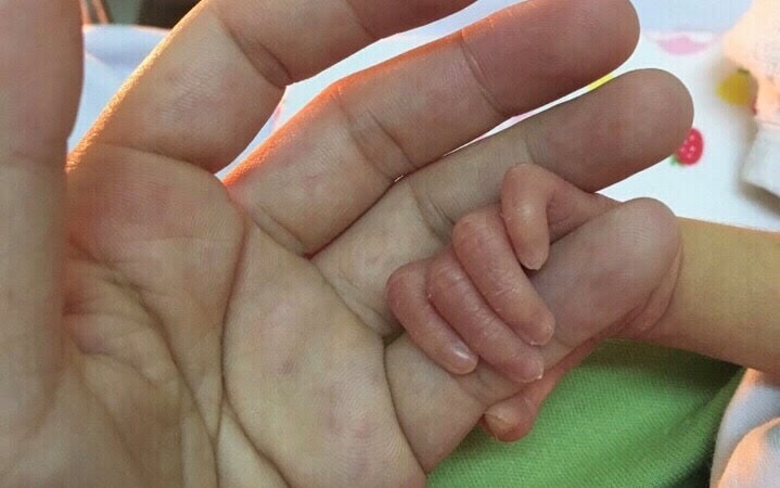 premature baby netizen