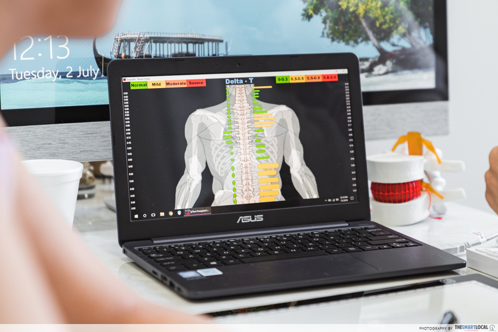 Macquarie Chiropractic Clinic Singapore Spinal Adjustment Thermographic Scan Digital Results