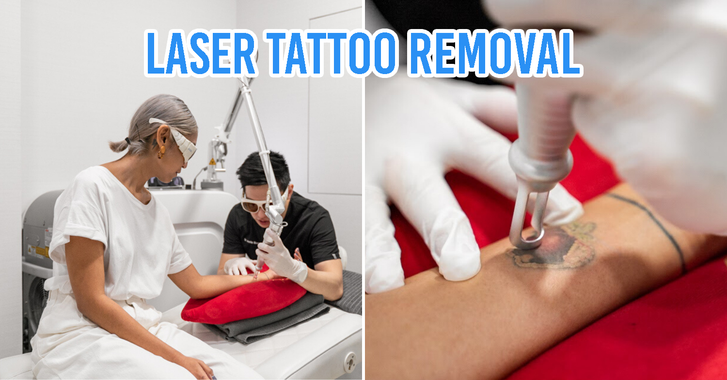 I Went For Tattoo Removal In Singapore To Undo My Poor Ink Choices 10 Years Ago