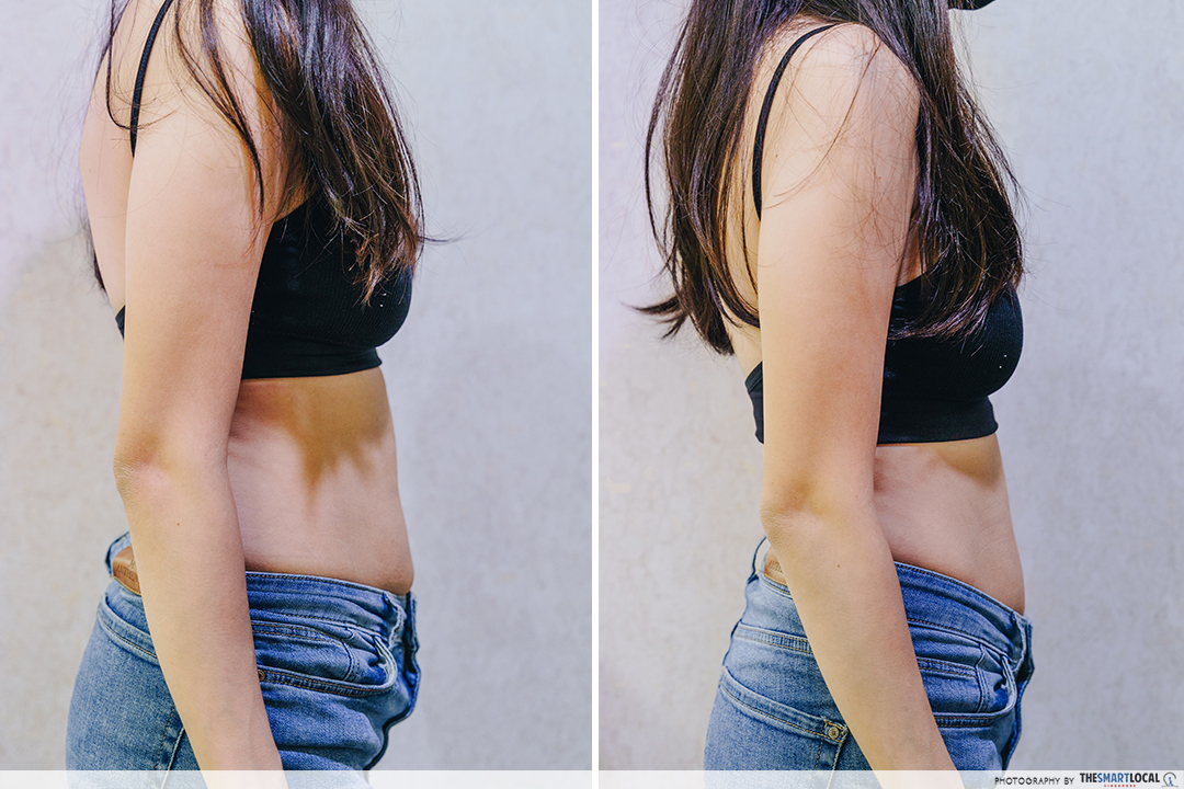 Before and after LUSH aesthetics body sculpting 