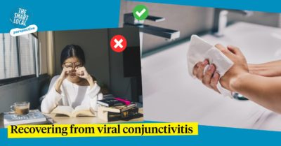 viral conjunctivitis
