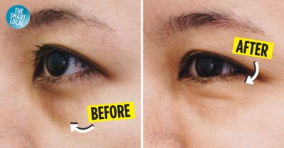 New York Skin Solutions Review Dark Eye Circle Treatment