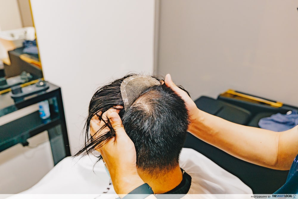 6 Hair Replacement Services In Singapore For Guys