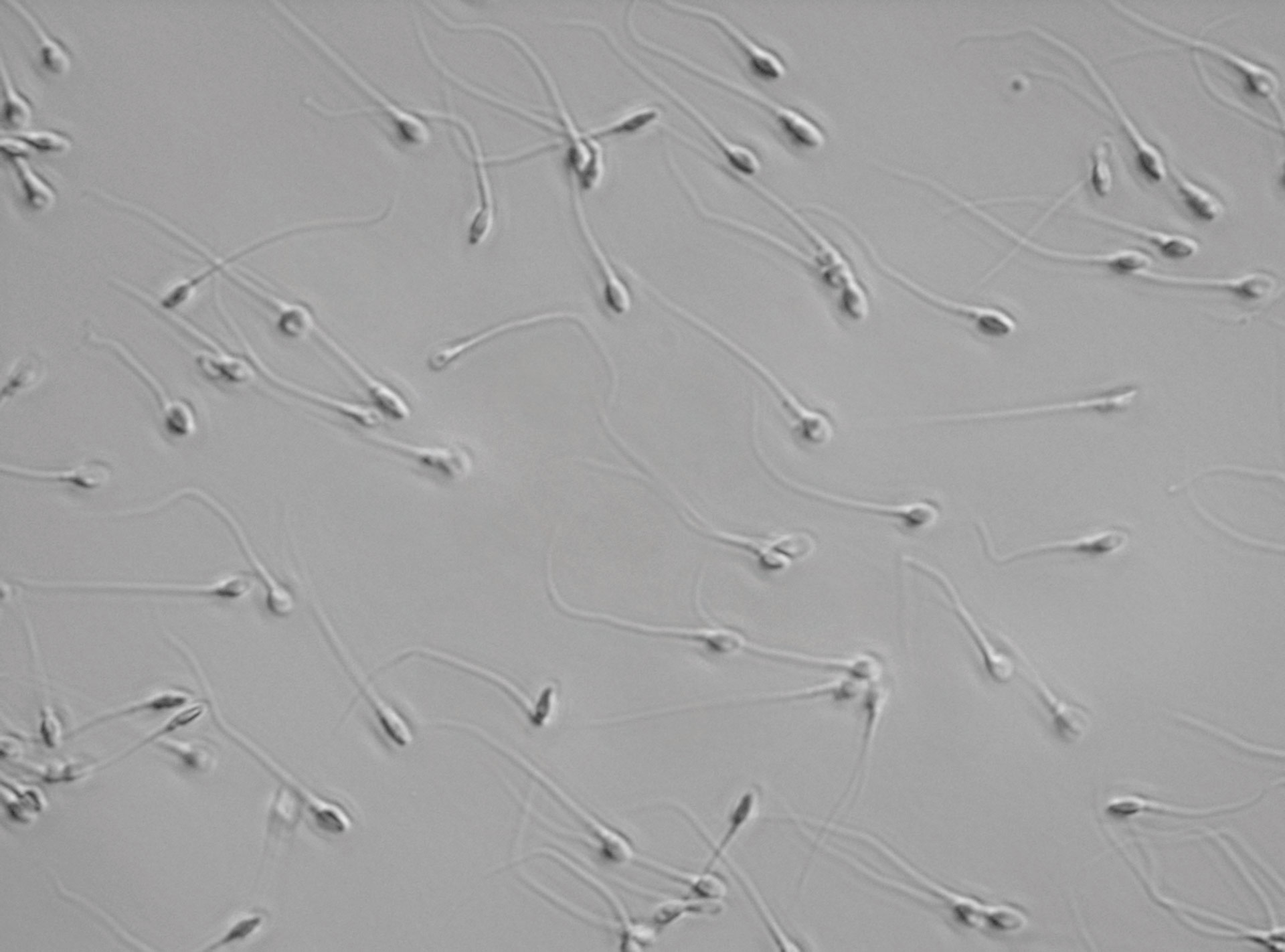 sperm cells