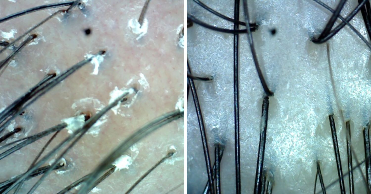 post-treatment scalp scan and review