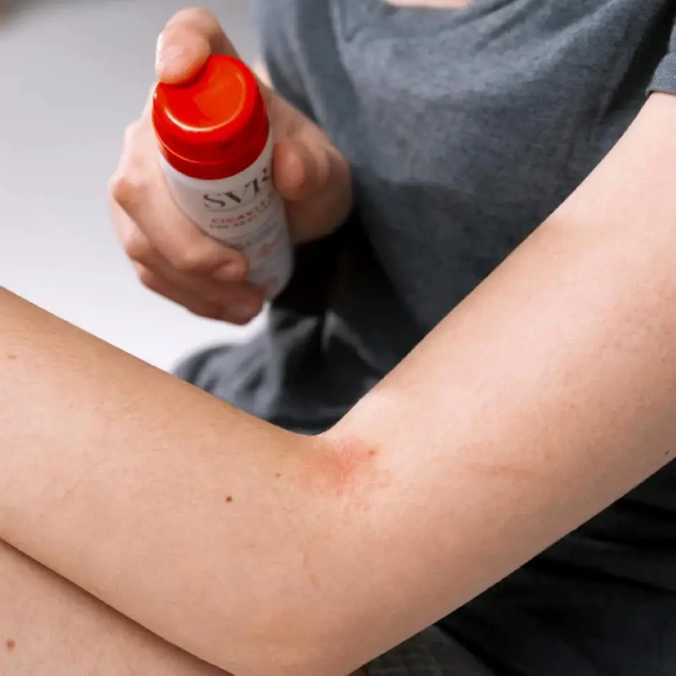 Itch Relief Products Singapore 13